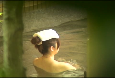         No.3 妊娠すれば安産確実！綺麗な顔なのに首に見えるの何？
    